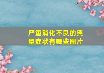 严重消化不良的典型症状有哪些图片