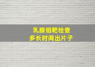 乳腺钼靶检查多长时间出片子