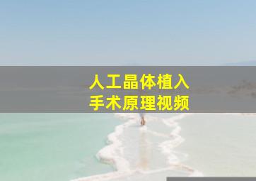 人工晶体植入手术原理视频