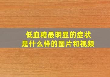 低血糖最明显的症状是什么样的图片和视频