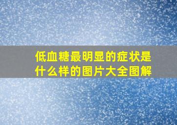 低血糖最明显的症状是什么样的图片大全图解