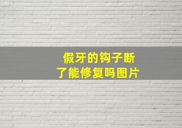 假牙的钩子断了能修复吗图片