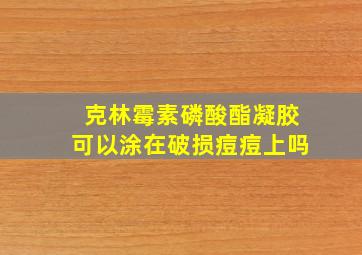 克林霉素磷酸酯凝胶可以涂在破损痘痘上吗