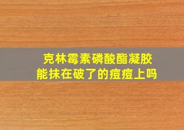 克林霉素磷酸酯凝胶能抹在破了的痘痘上吗