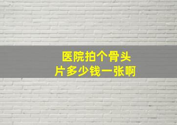 医院拍个骨头片多少钱一张啊