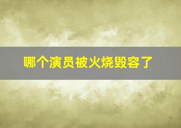 哪个演员被火烧毁容了