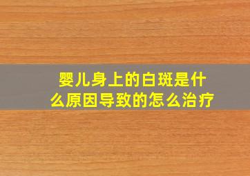 婴儿身上的白斑是什么原因导致的怎么治疗