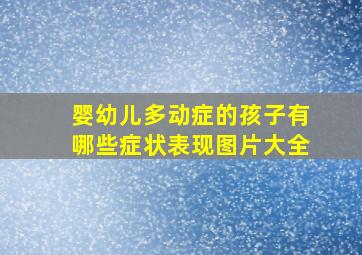 婴幼儿多动症的孩子有哪些症状表现图片大全