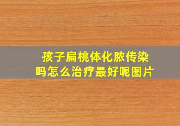 孩子扁桃体化脓传染吗怎么治疗最好呢图片