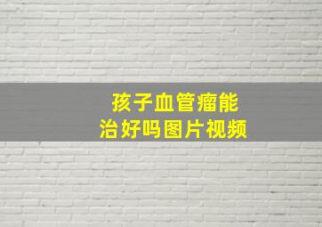 孩子血管瘤能治好吗图片视频