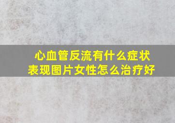 心血管反流有什么症状表现图片女性怎么治疗好