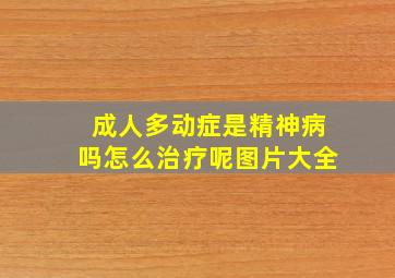 成人多动症是精神病吗怎么治疗呢图片大全