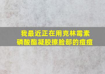 我最近正在用克林霉素磷酸酯凝胶擦脸部的痘痘