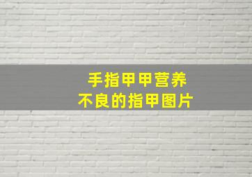 手指甲甲营养不良的指甲图片