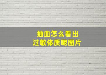 抽血怎么看出过敏体质呢图片