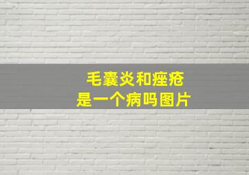 毛囊炎和痤疮是一个病吗图片