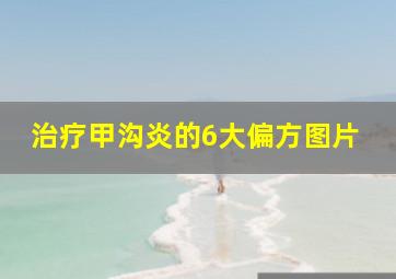 治疗甲沟炎的6大偏方图片