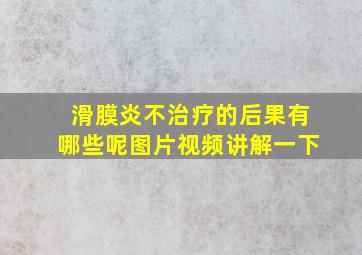 滑膜炎不治疗的后果有哪些呢图片视频讲解一下