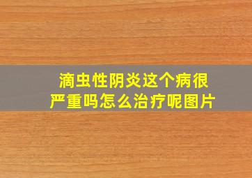 滴虫性阴炎这个病很严重吗怎么治疗呢图片