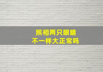 照相两只眼睛不一样大正常吗