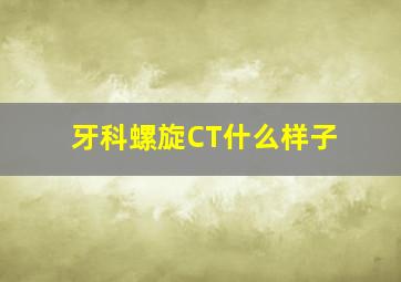 牙科螺旋CT什么样子