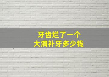 牙齿烂了一个大洞补牙多少钱