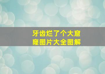 牙齿烂了个大窟窿图片大全图解