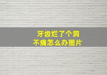 牙齿烂了个洞不痛怎么办图片