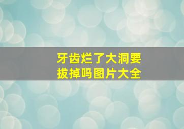 牙齿烂了大洞要拔掉吗图片大全