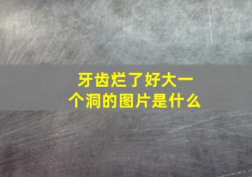 牙齿烂了好大一个洞的图片是什么