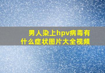 男人染上hpv病毒有什么症状图片大全视频