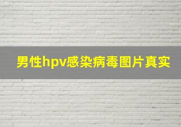 男性hpv感染病毒图片真实