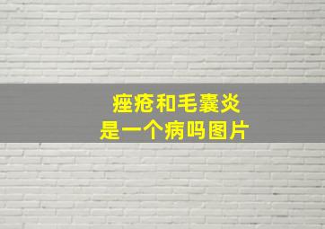 痤疮和毛囊炎是一个病吗图片