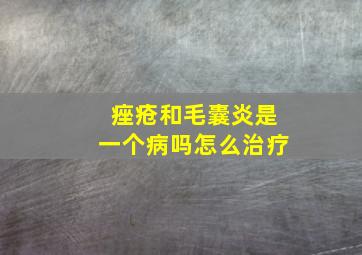 痤疮和毛囊炎是一个病吗怎么治疗