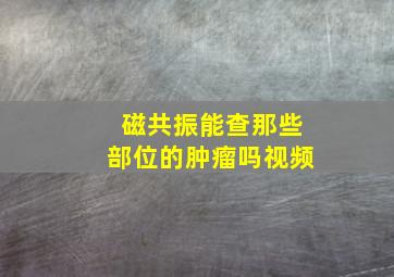 磁共振能查那些部位的肿瘤吗视频