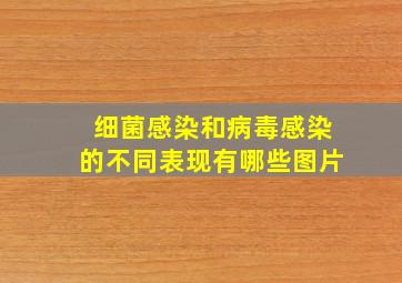 细菌感染和病毒感染的不同表现有哪些图片