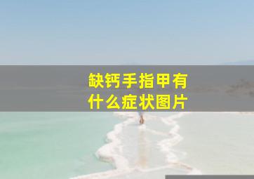 缺钙手指甲有什么症状图片