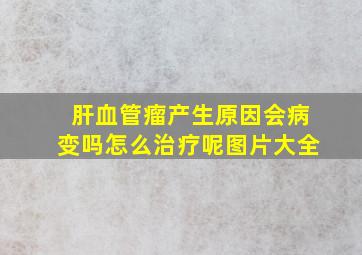 肝血管瘤产生原因会病变吗怎么治疗呢图片大全