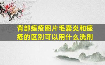 背部痤疮图片毛囊炎和痤疮的区别可以用什么洗剂