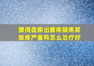 腰间盘膨出腰疼腿疼屁股疼严重吗怎么治疗好