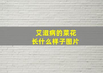 艾滋病的菜花长什么样子图片