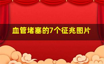 血管堵塞的7个征兆图片