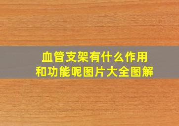 血管支架有什么作用和功能呢图片大全图解