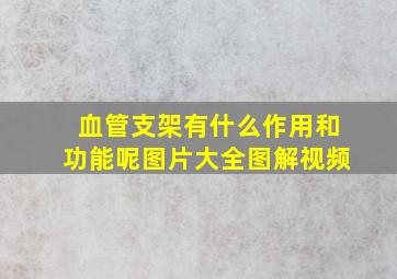 血管支架有什么作用和功能呢图片大全图解视频