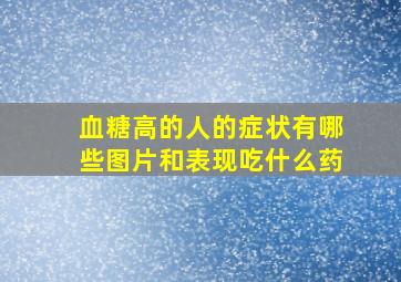 血糖高的人的症状有哪些图片和表现吃什么药