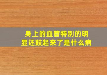 身上的血管特别的明显还鼓起来了是什么病