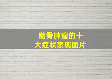 髂骨肿瘤的十大症状表现图片