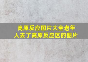 高原反应图片大全老年人去了高原反应区的图片