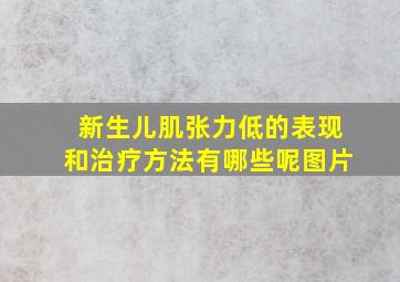 新生儿肌张力低的表现和治疗方法有哪些呢图片