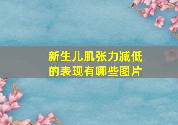 新生儿肌张力减低的表现有哪些图片